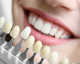 How deeply stained your teeth are is one factor that affects the cost of teeth whitening